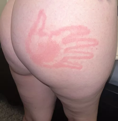 I love it when it welts up