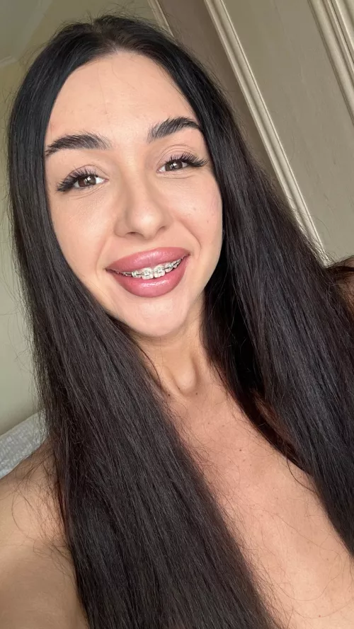 A smiley face with braces