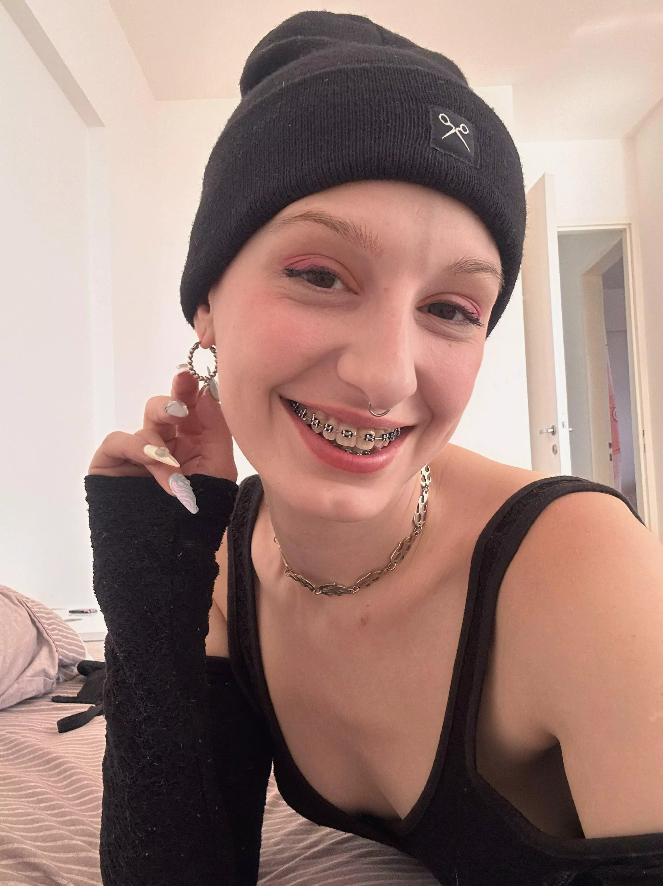 i know you love my braces!!