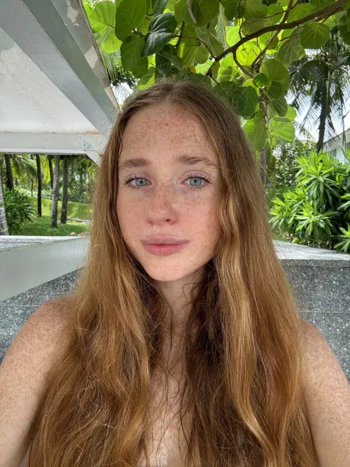 Embracing my freckled face [IRTR]