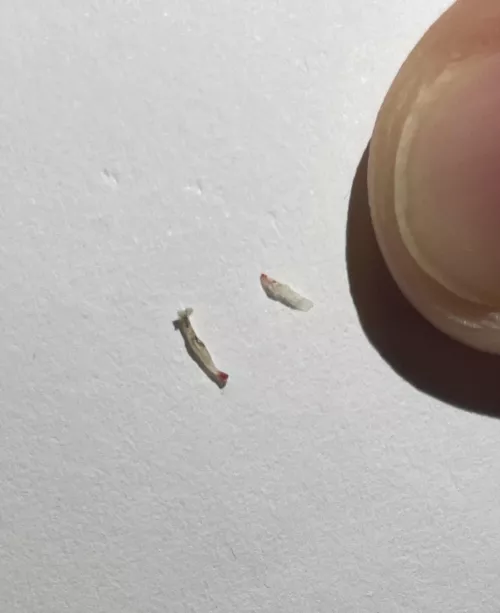 I tweezed something strange from my skin