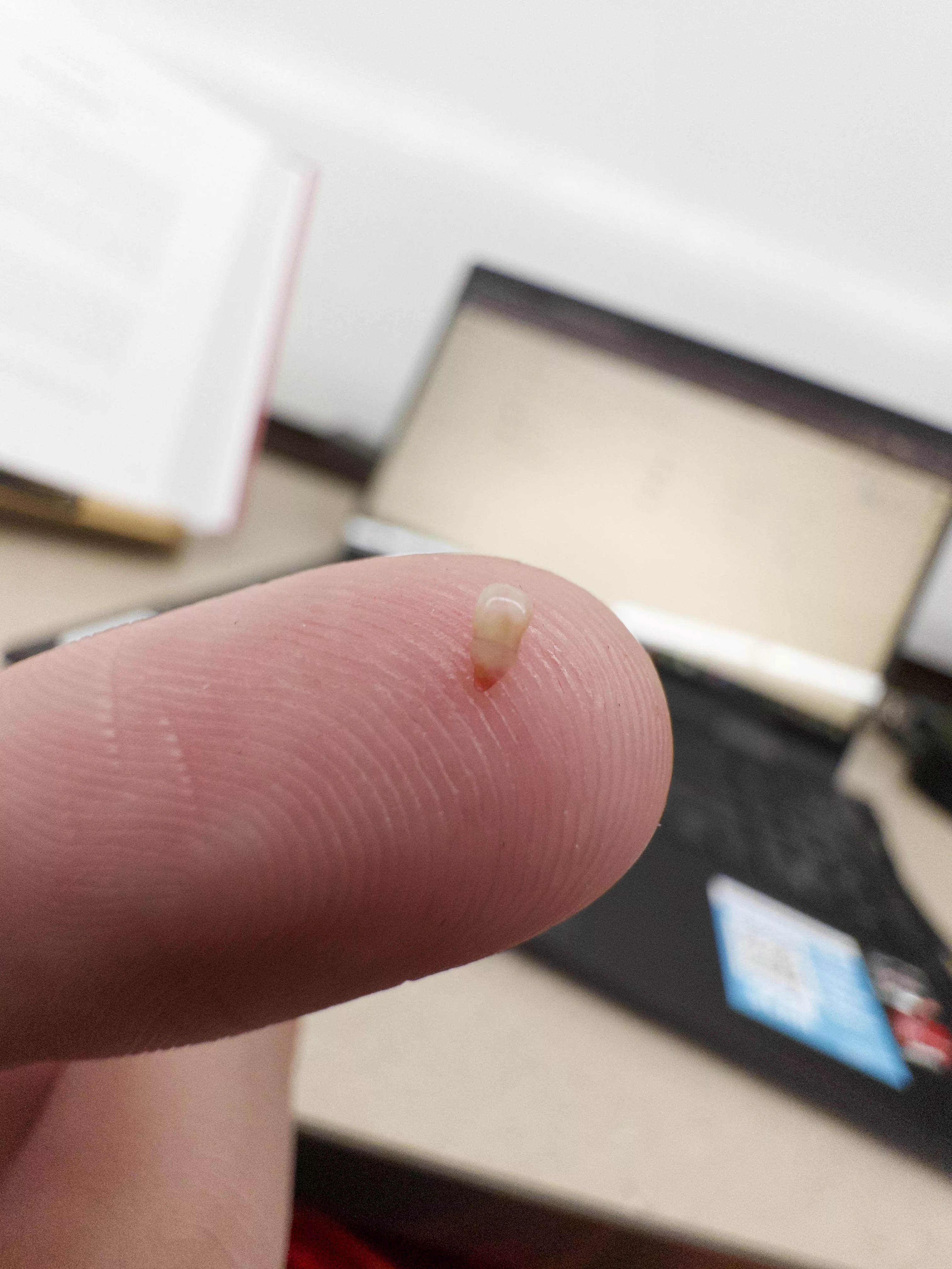 Just yoinked this little guy out of my back