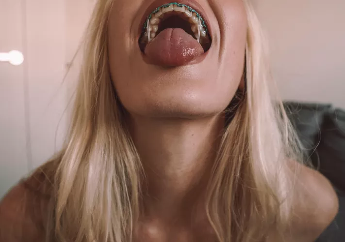 Say ‘aaaahhhhh’ 👅