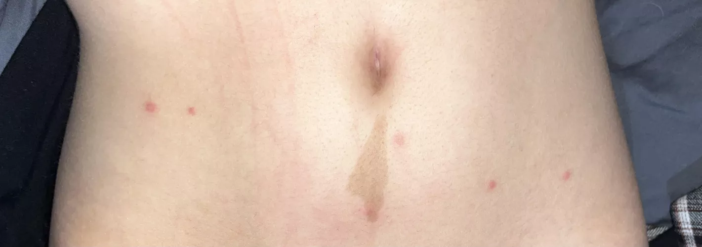 Any idea what these spots are?