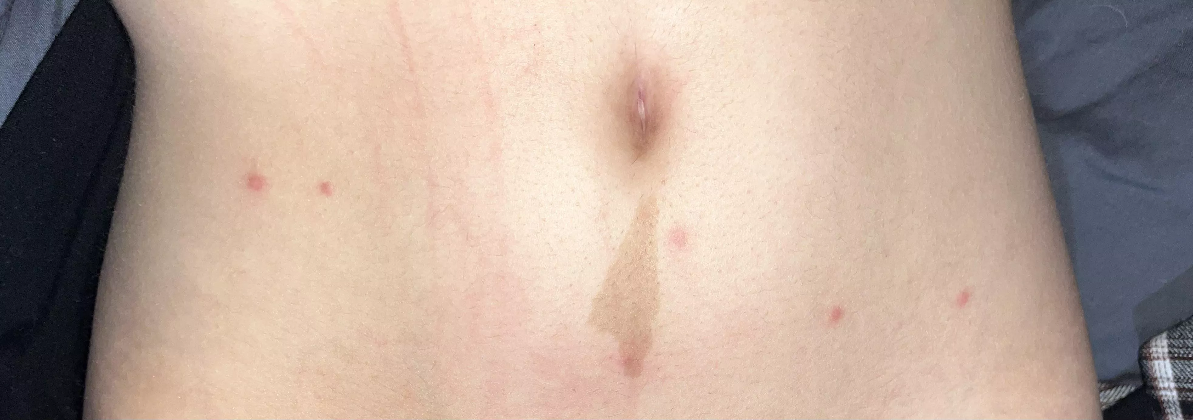 Any idea what these spots are?