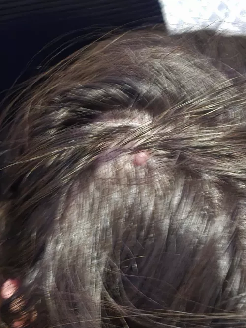 Does anyone know what kind of bump this is 