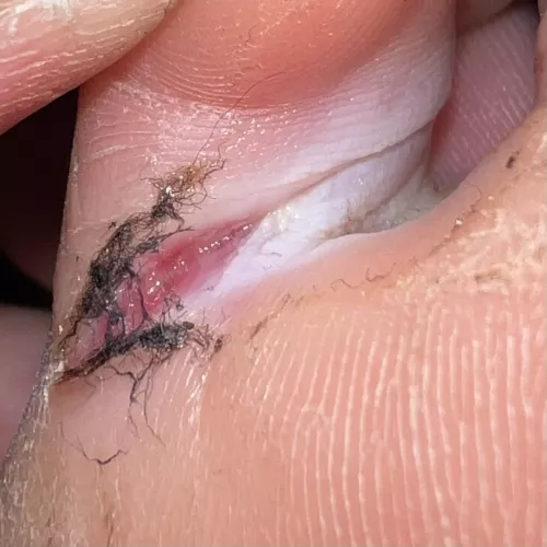 Does this need a stitch?