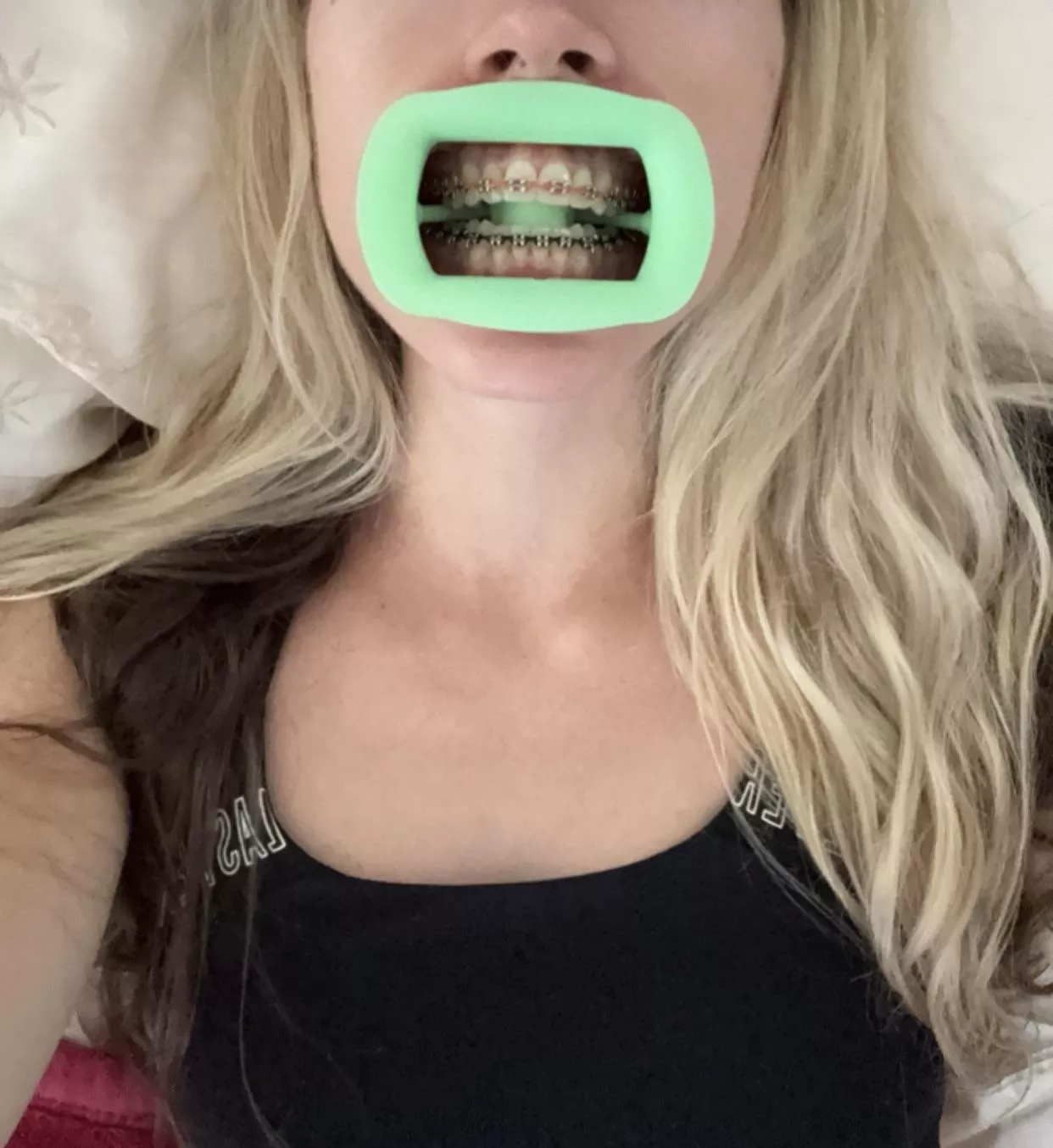 I could leave this retractor in all day, it’s so comfy