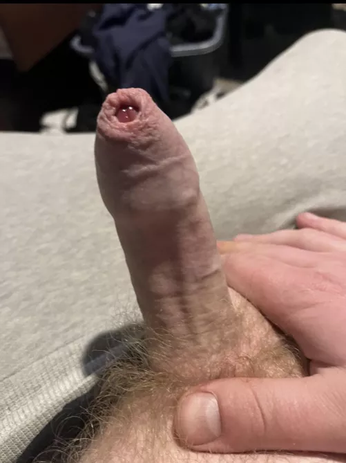 I love foreskin so much and wanna suck everyone in here( here’s mine)
