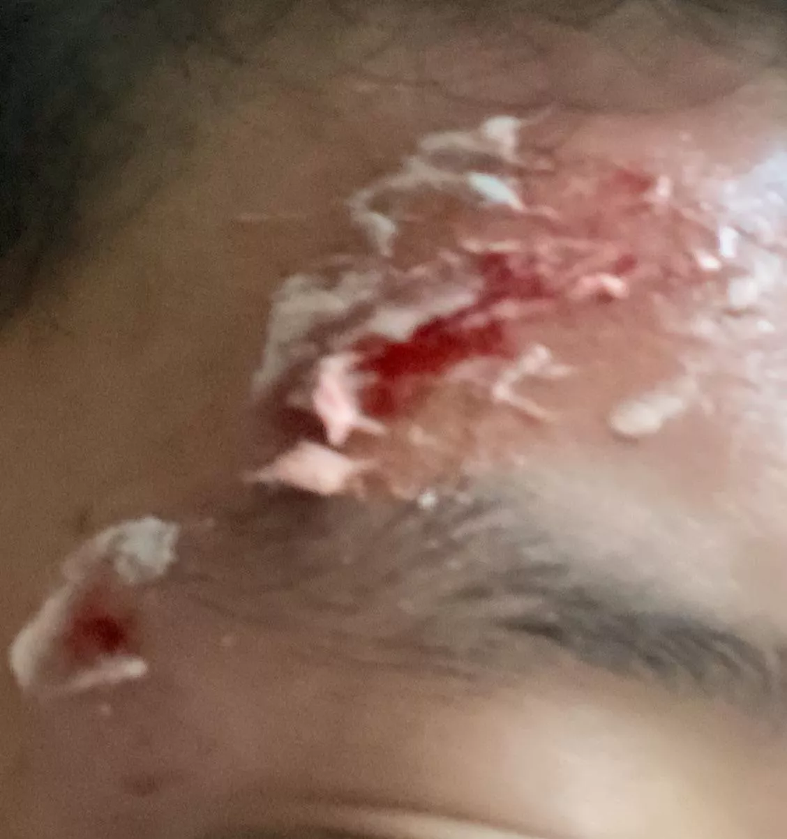 Just hit head very hard is this gonna leave a scar