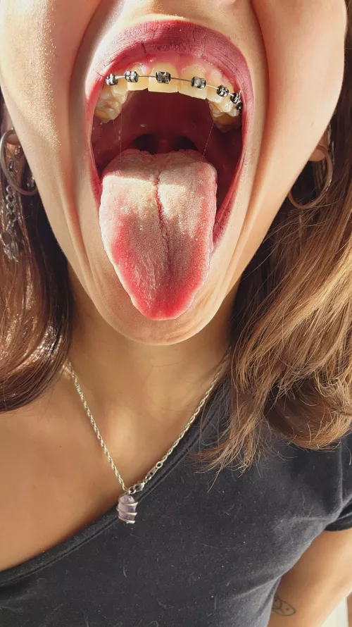 Come my little beta, I'll chew you up