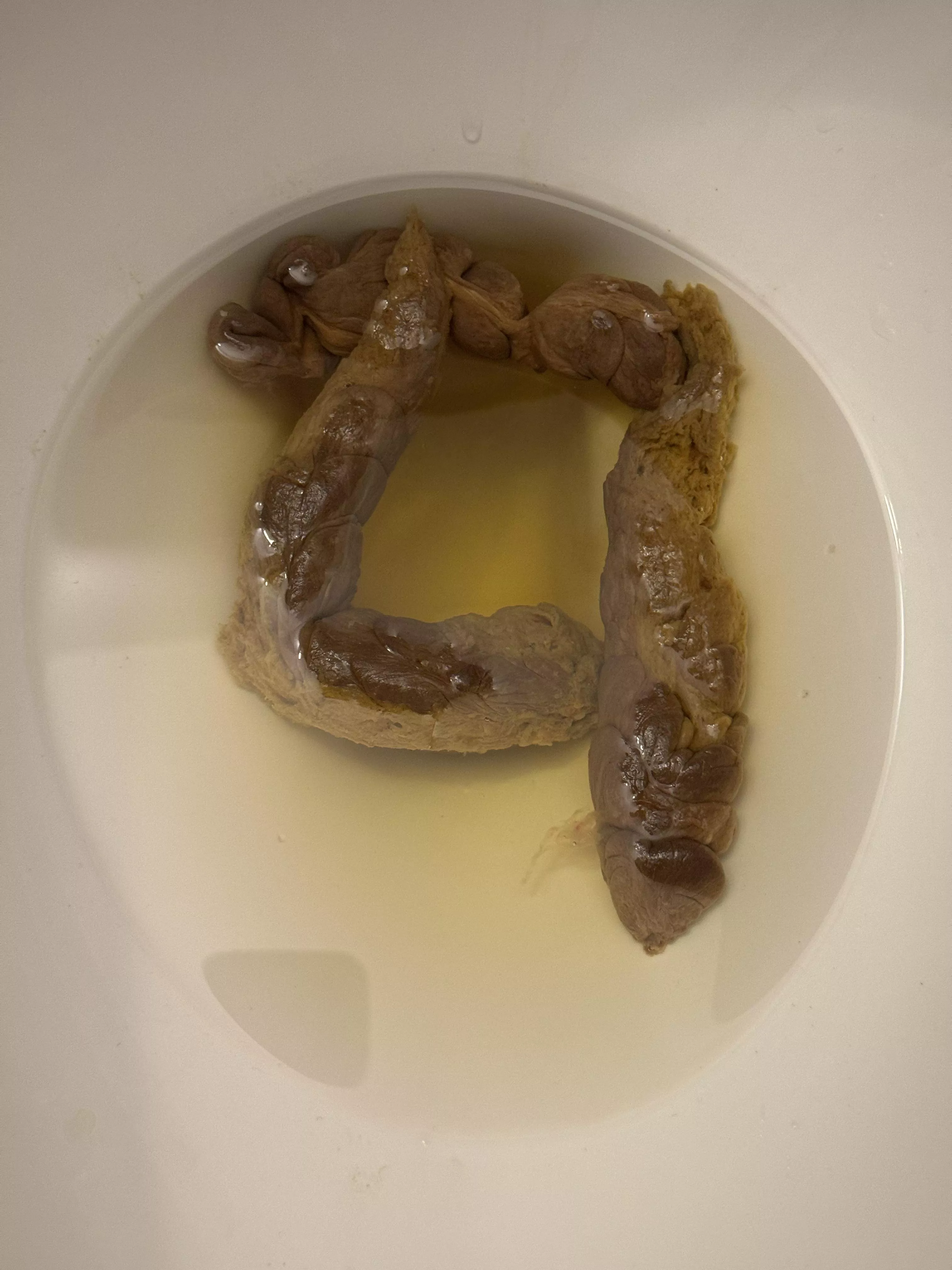 Have you ever had a square poop? 