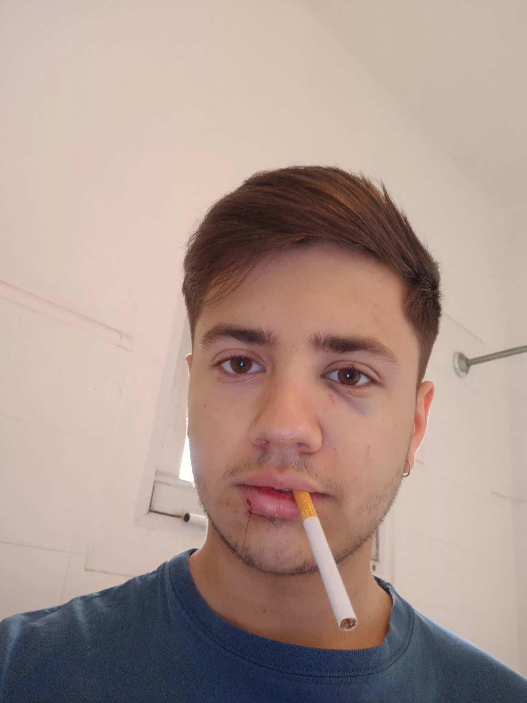 I got into a fight last night