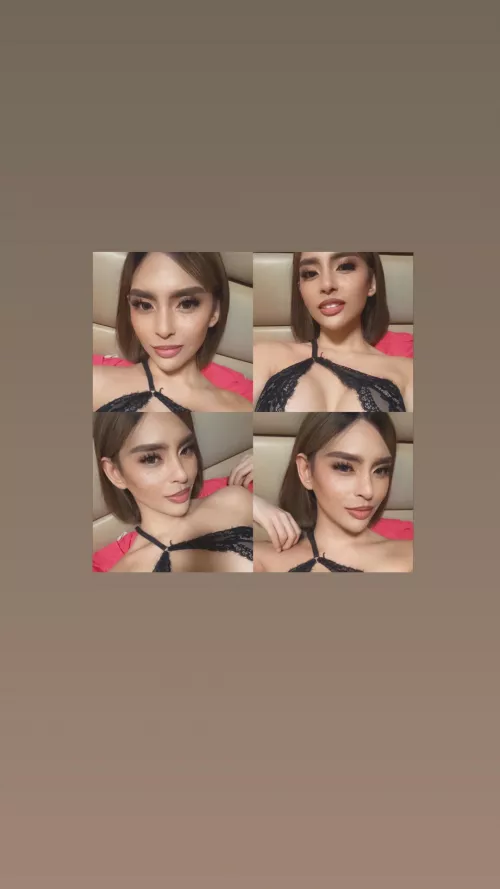 Pre Op Trans from QC. Available TODAY TODAY TODAY!