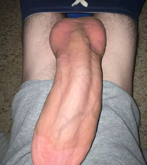 That wasn’t Tylenol!!!!