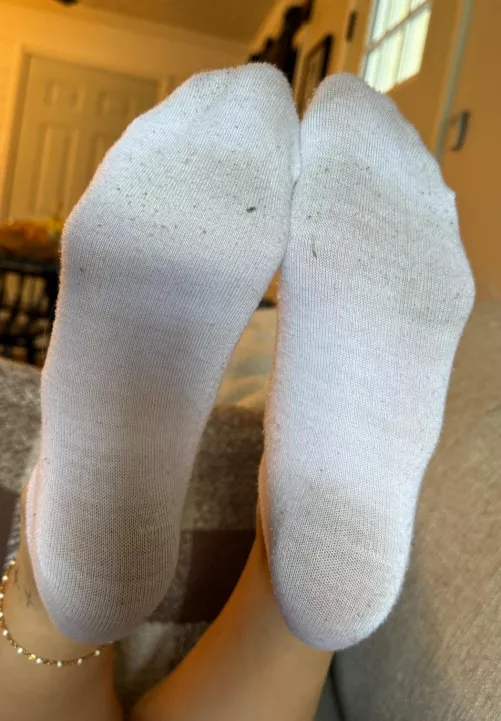 Wife’s amazing ankle socks after a run 
