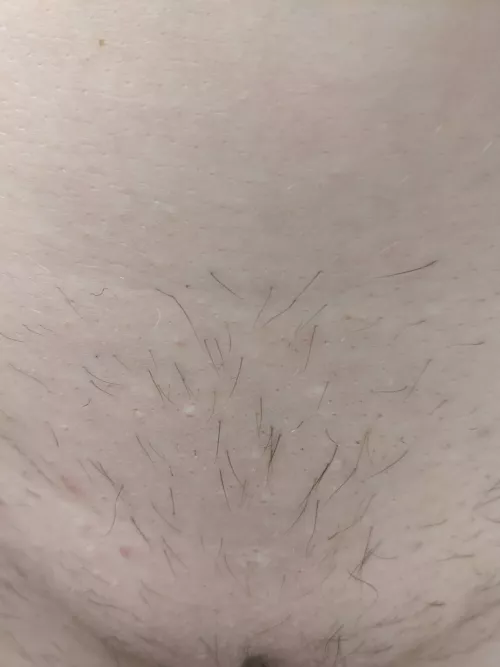 Can I still can a brazilian even if my hair has grown back patchy?