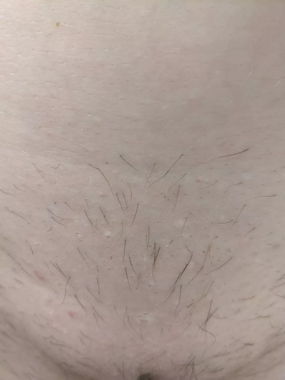 Can I still can a brazilian even if my hair has grown back patchy?