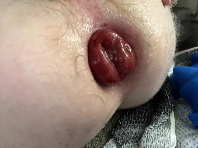 First time anal pump to try and pull my rosebud out more - I think I’ll be doing this a lot more often