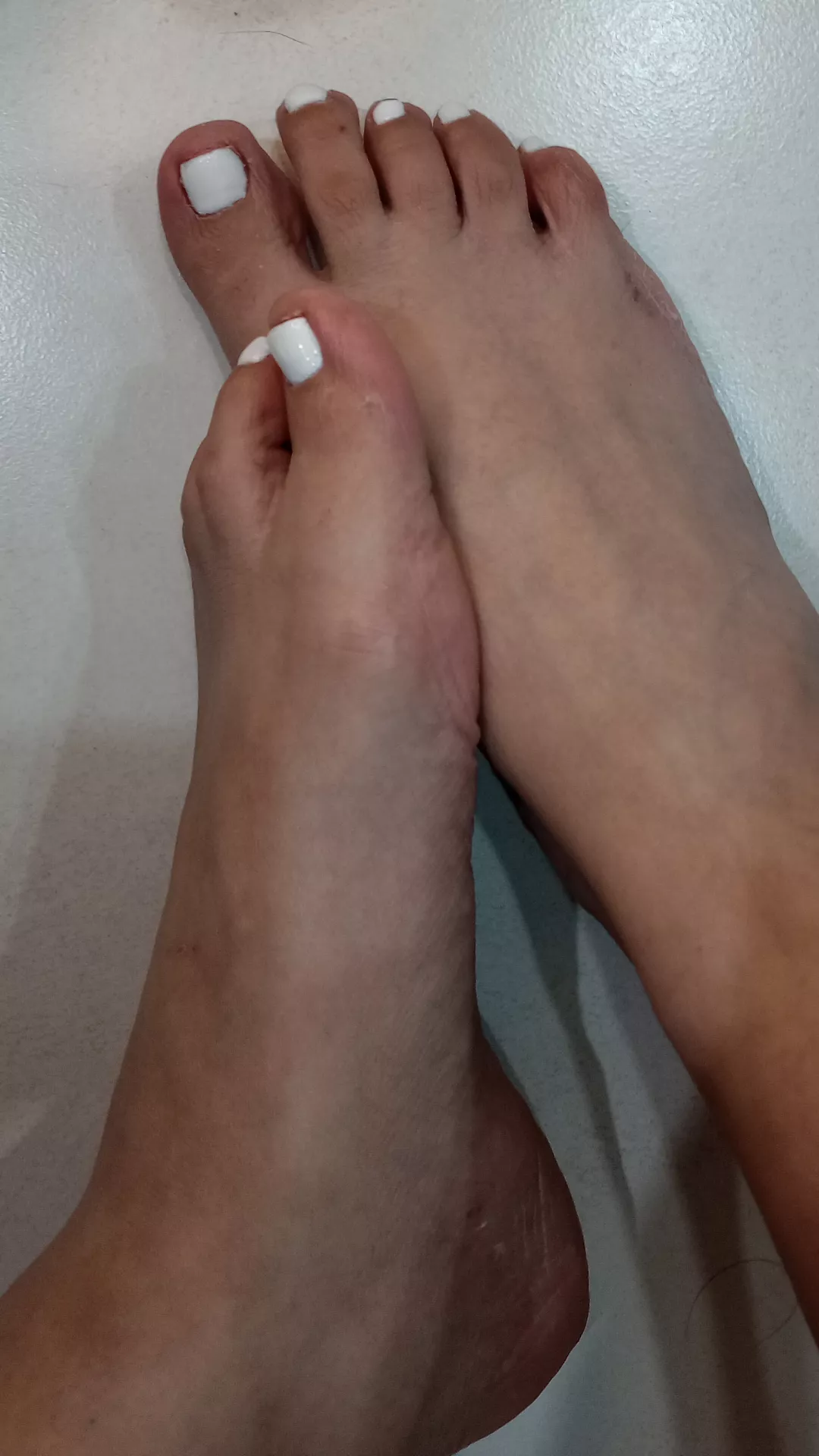 White toes and soft feet 