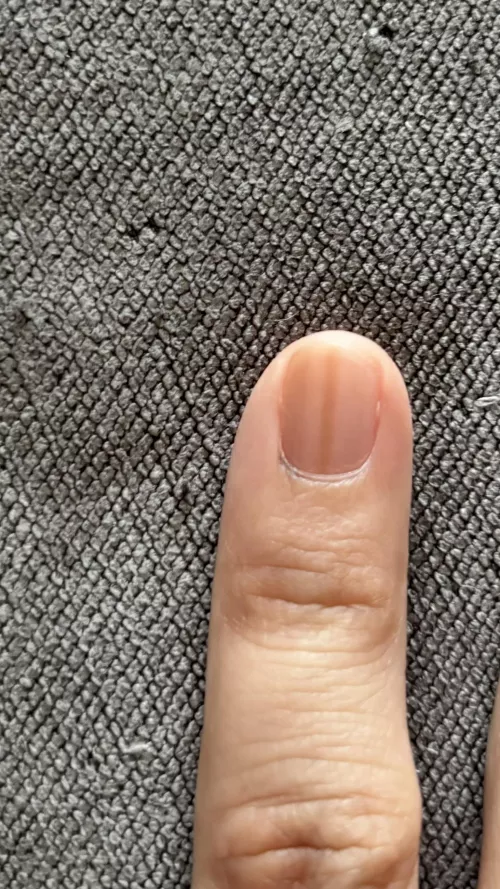Brown line on nail and darkening on the side 
