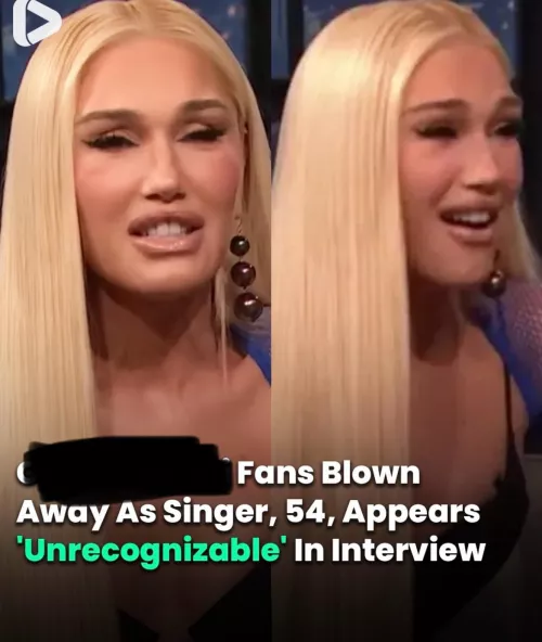 I always thought she was really beautiful so this is surprising and sad to see 