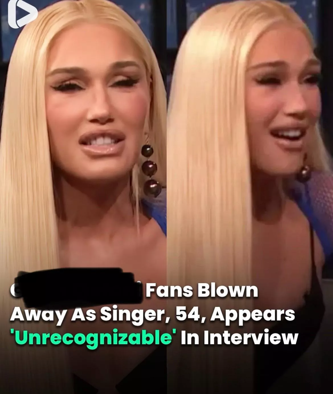 I always thought she was really beautiful so this is surprising and sad to see 