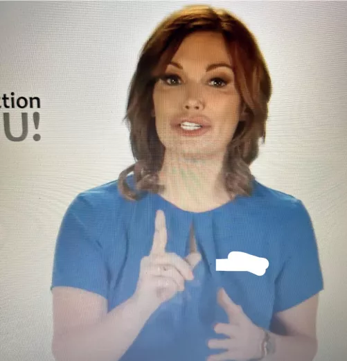 So much filler, looks like a moustache 