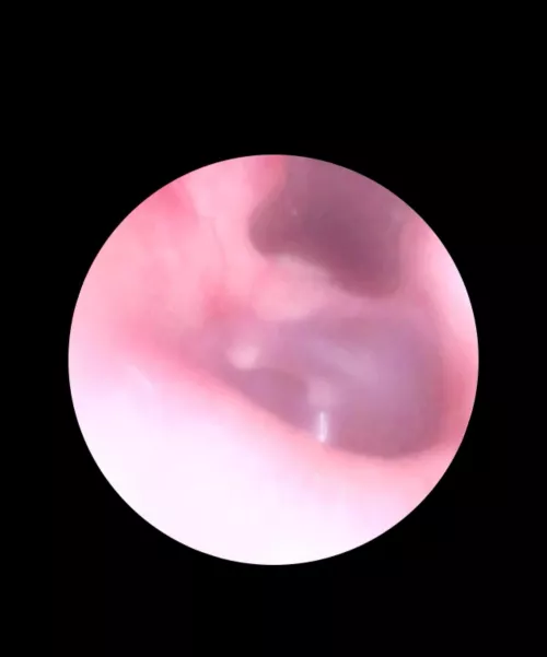 White spots in ear??