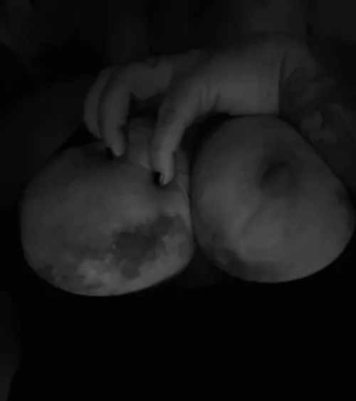 Bruised breasts look like the moon 😻