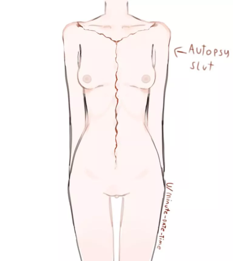 Is anyone else into medical guro?