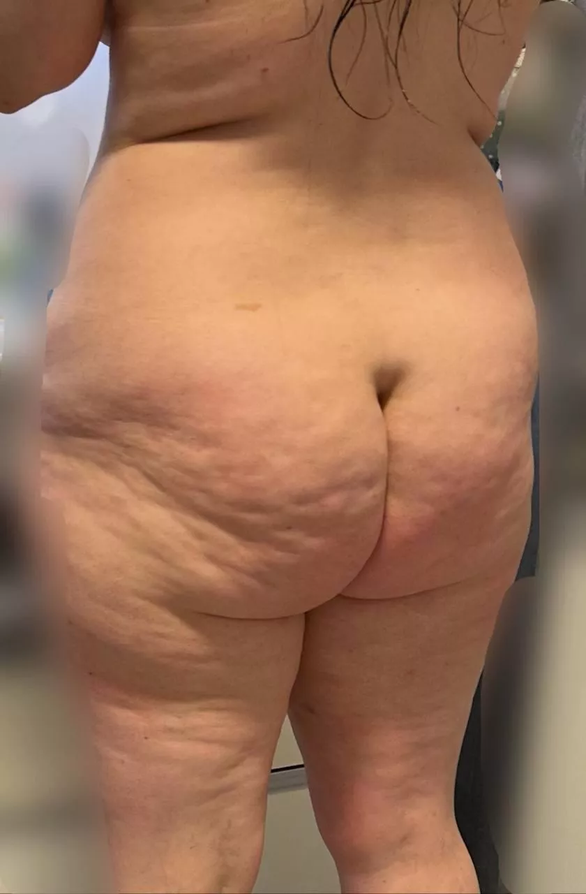 My wife's (33) dimples