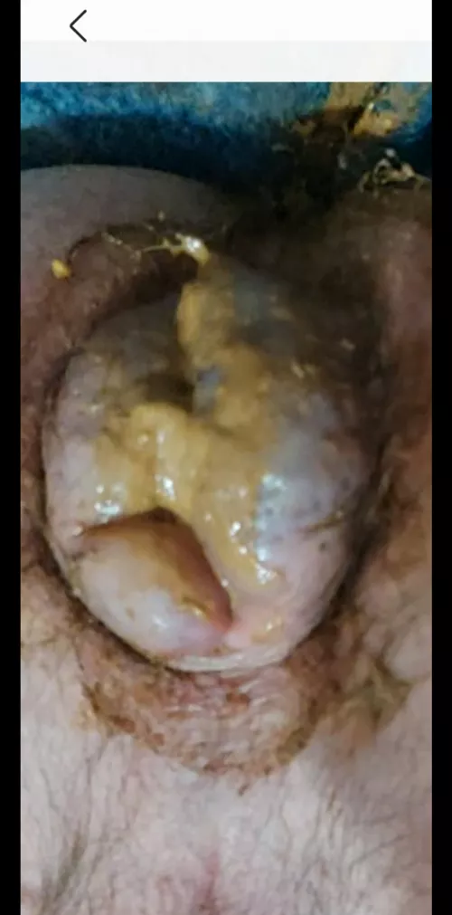 Shitty UK arse play.