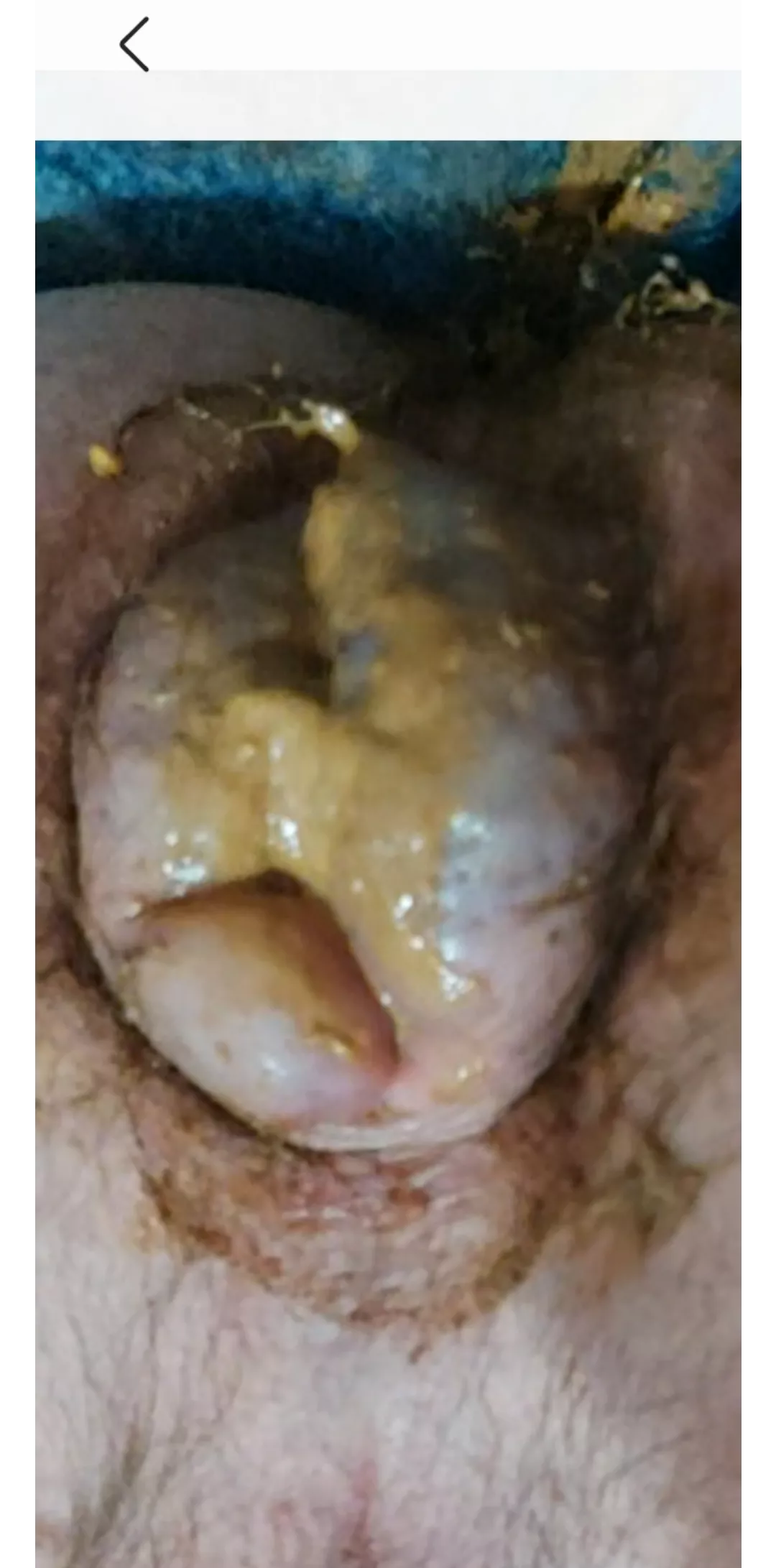 Shitty UK arse play.