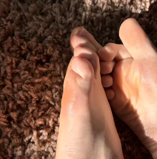 Sweaty feet