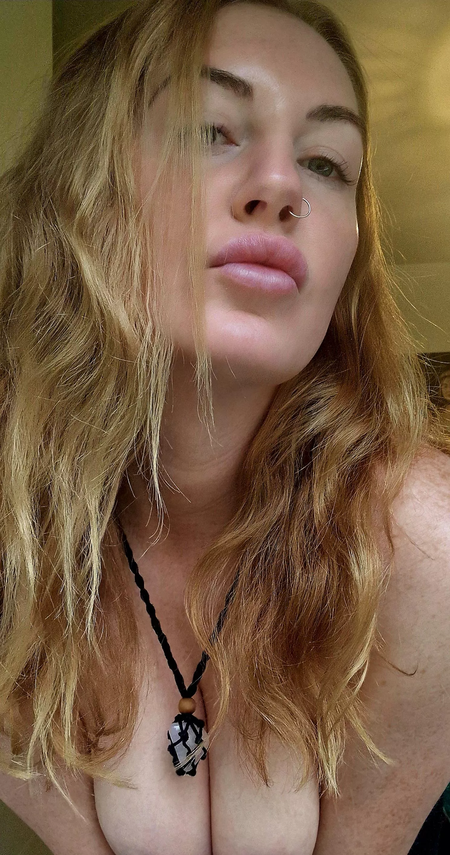  The sun has dissappeared but my freckles are here to stay [IRTR]