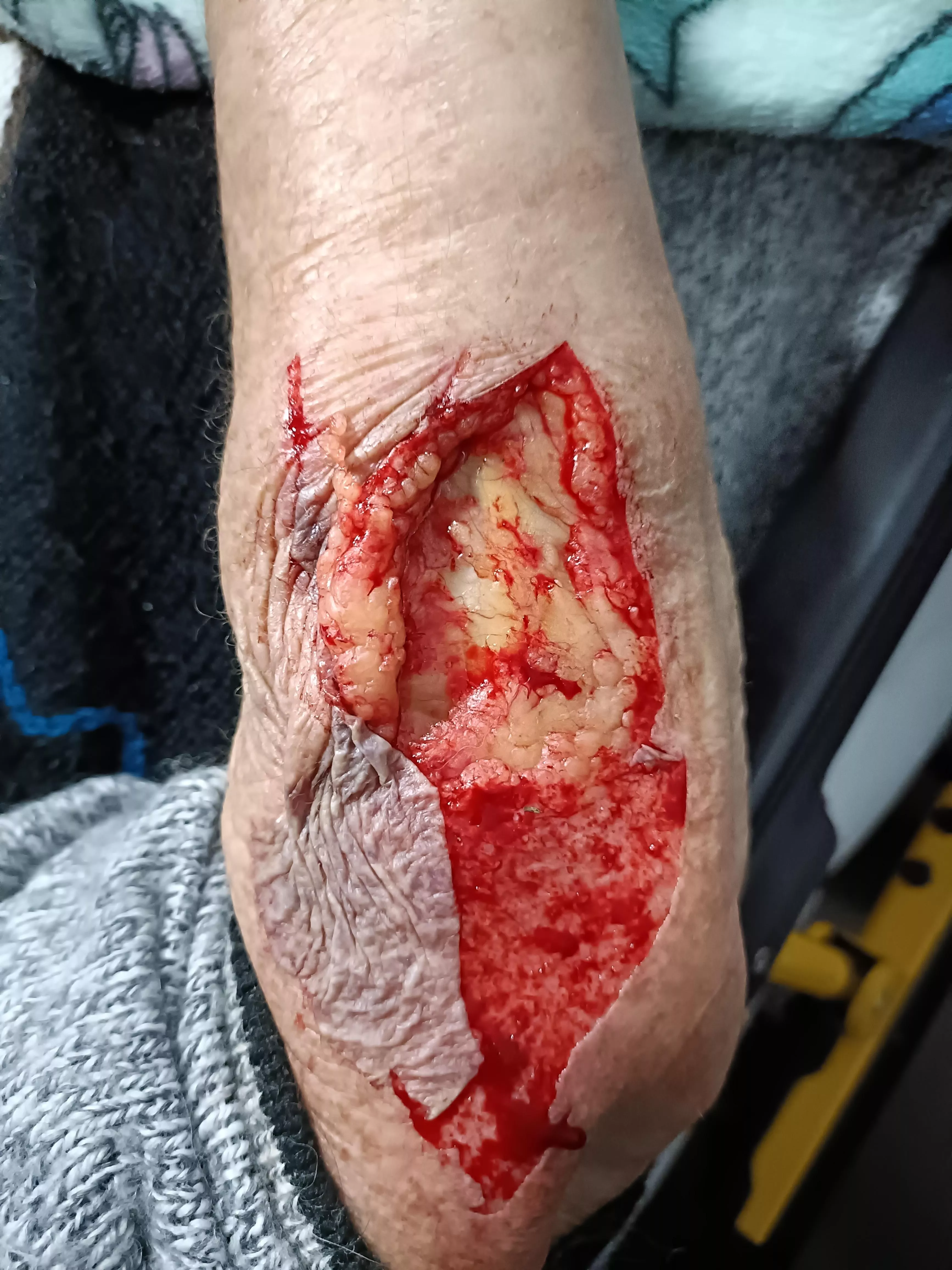 Old people skin is the worst 