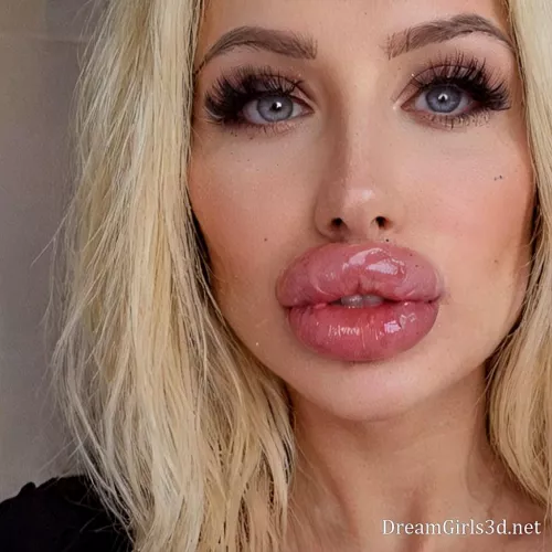 Blonde beauty with enviable lip fillers