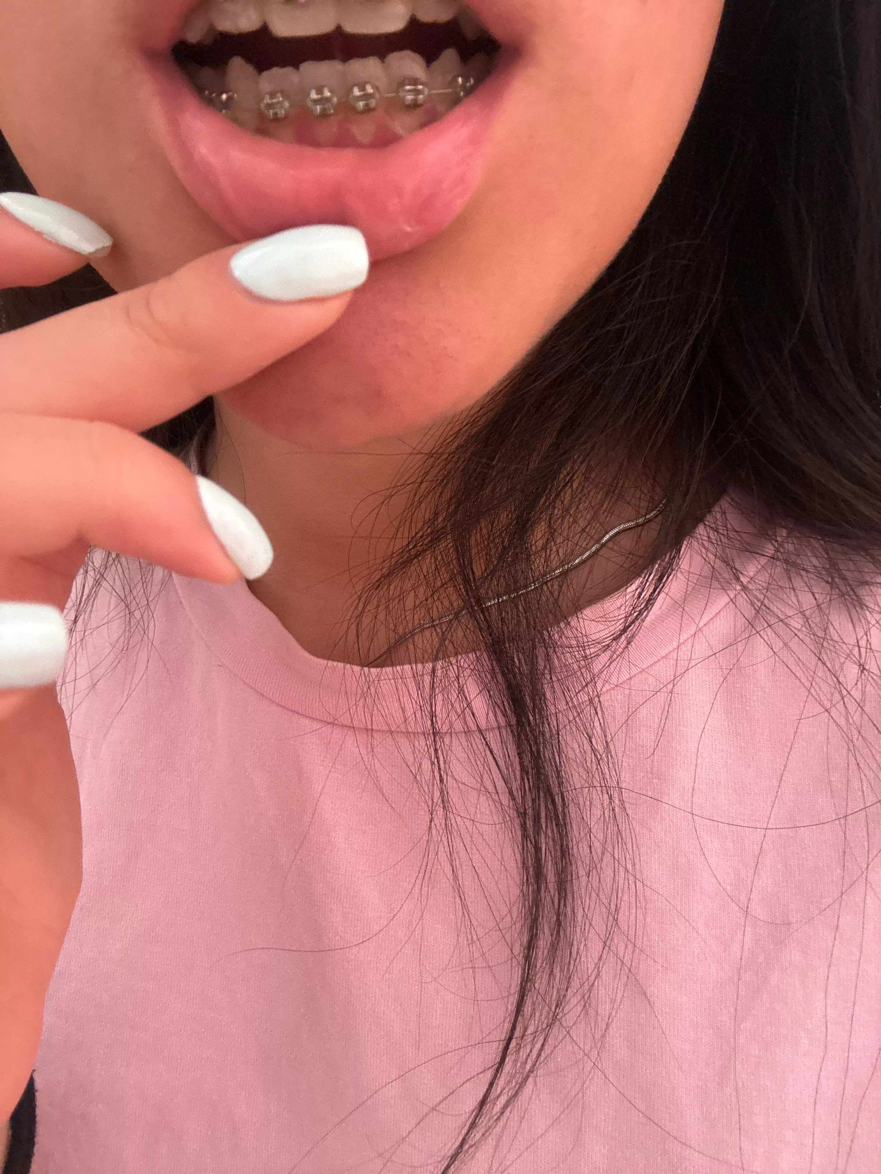 do you like my braces from below?