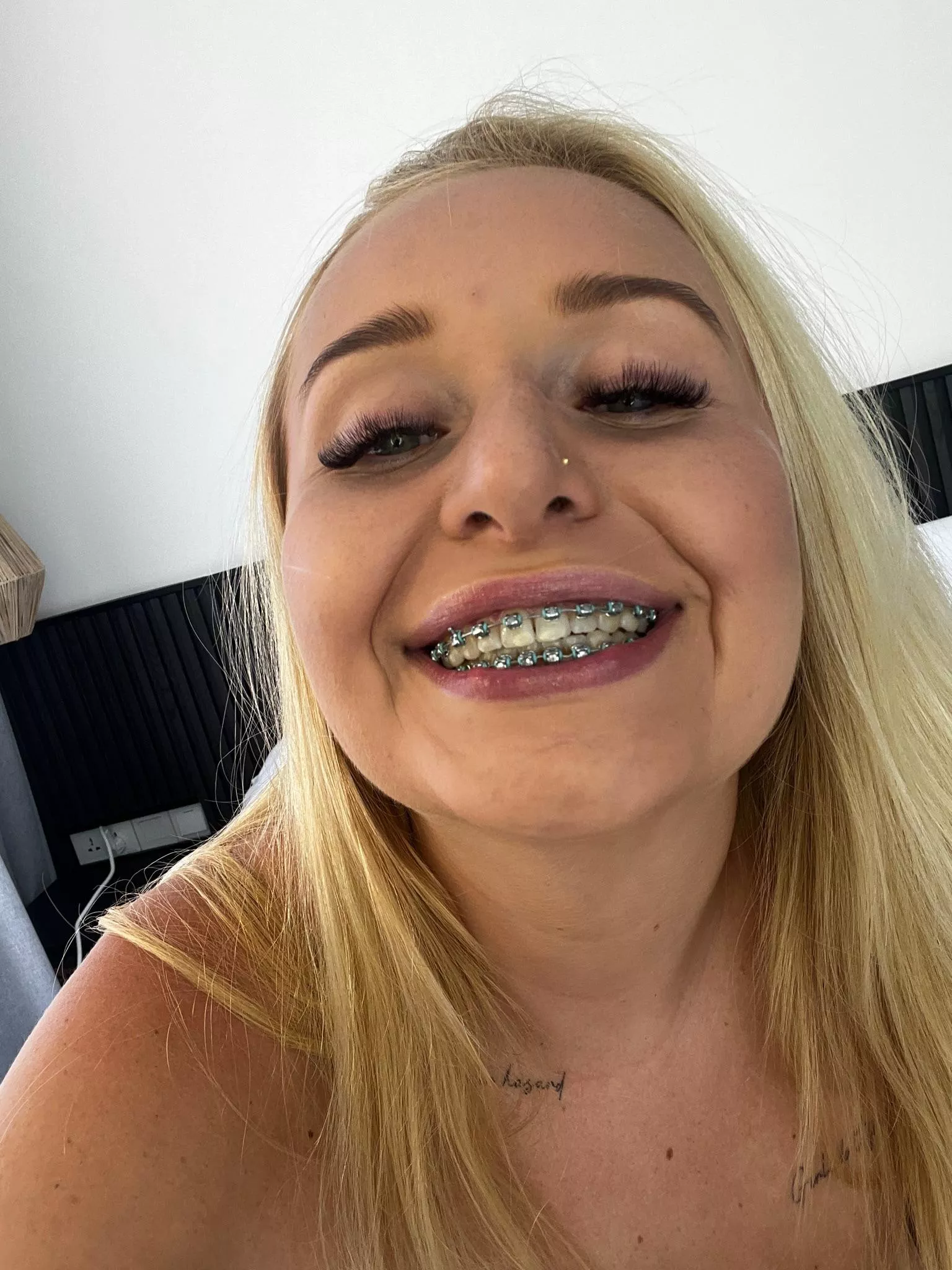 Do you like my braces ?