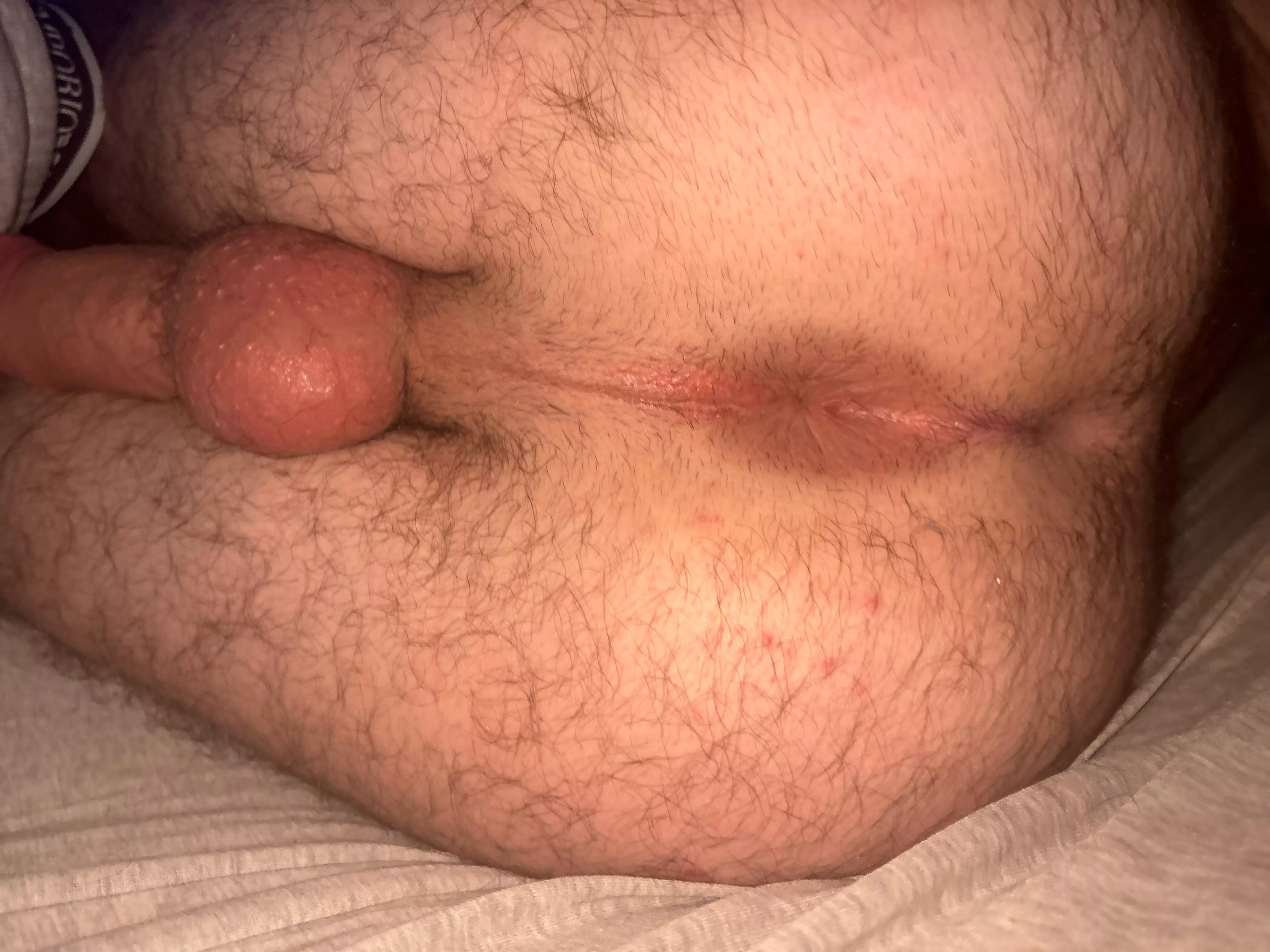 I need filled up so badly age [19]