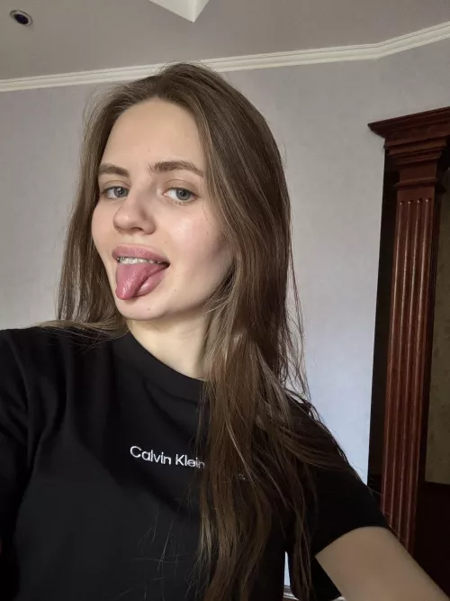 I think my braces look extra cute today. What do you think?