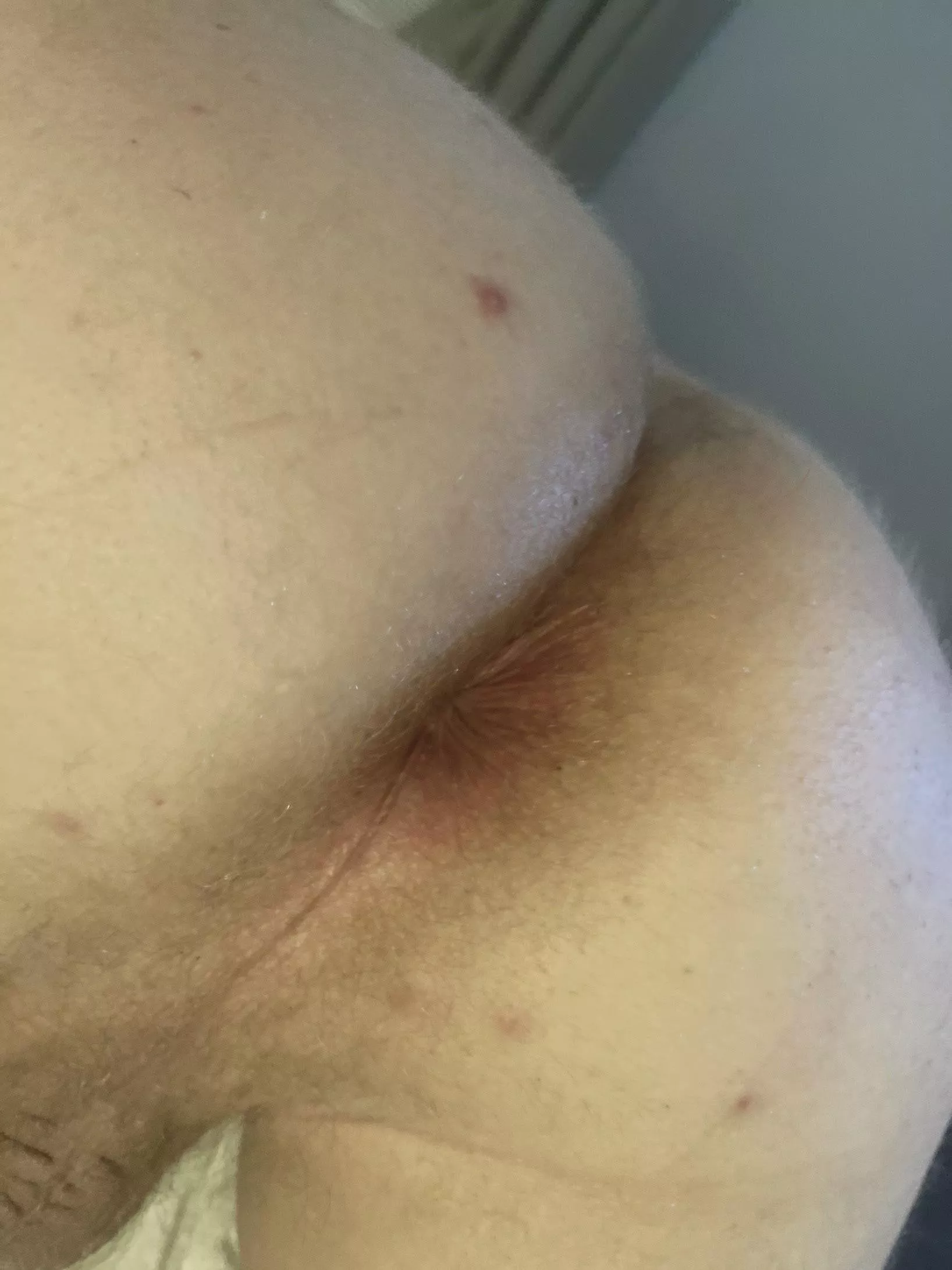 Age[25] Bored with nothing to do today