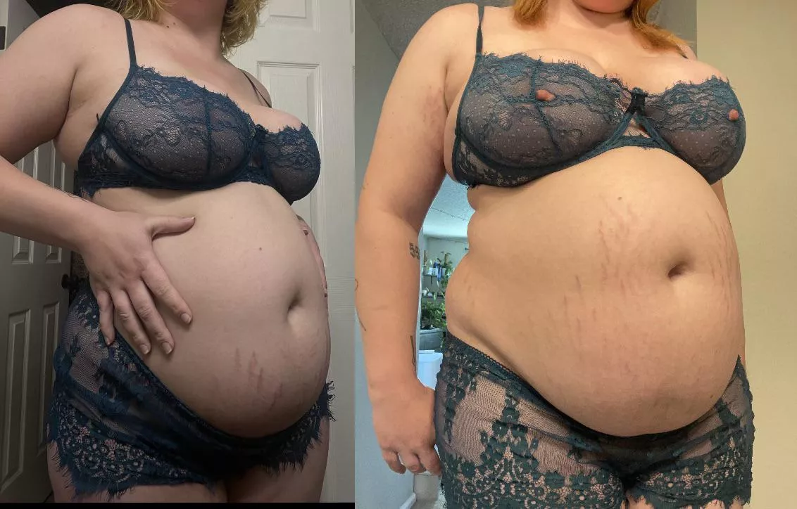 stretch marks go crazy