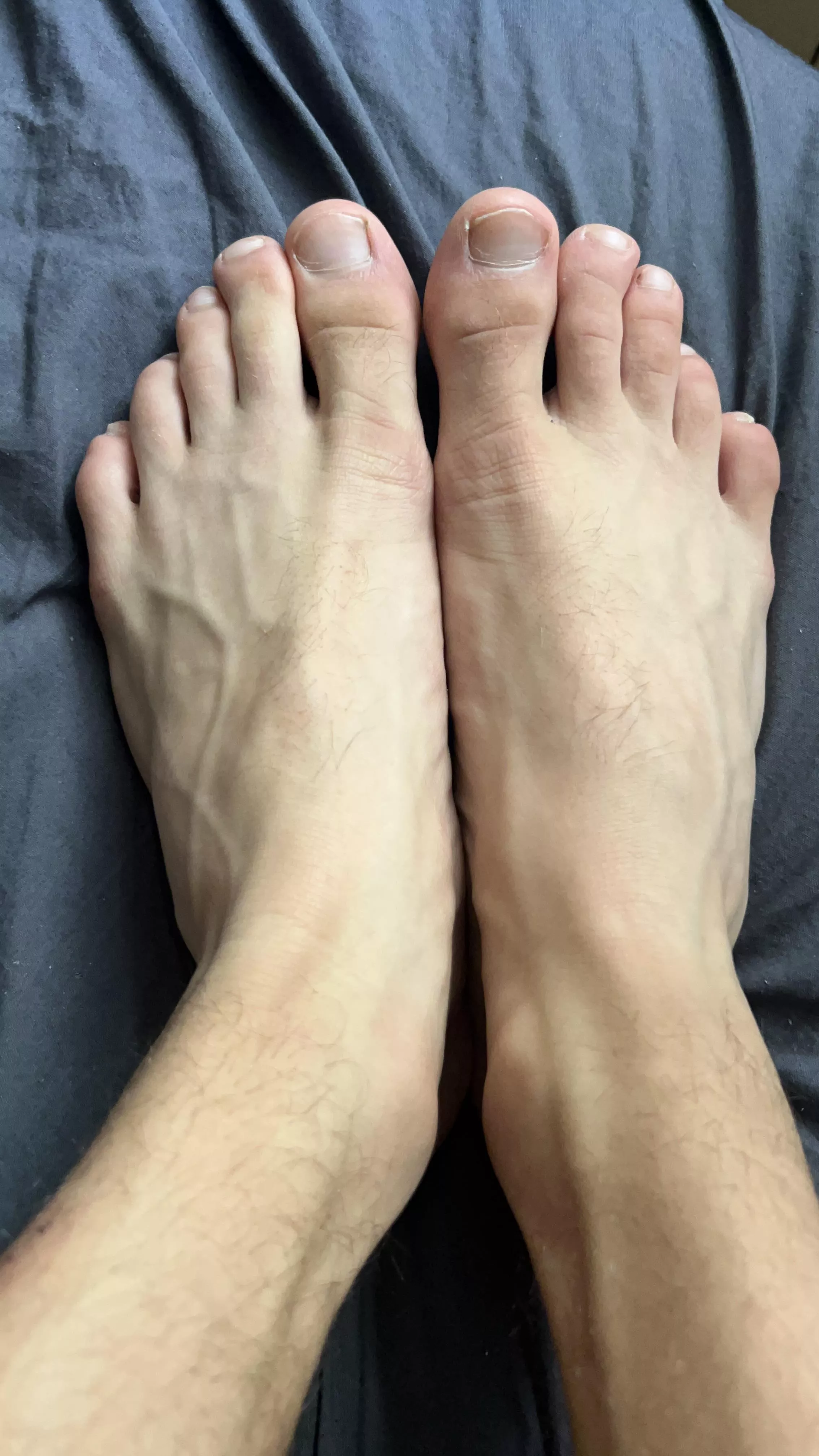 Rate my feet from 1 to 10