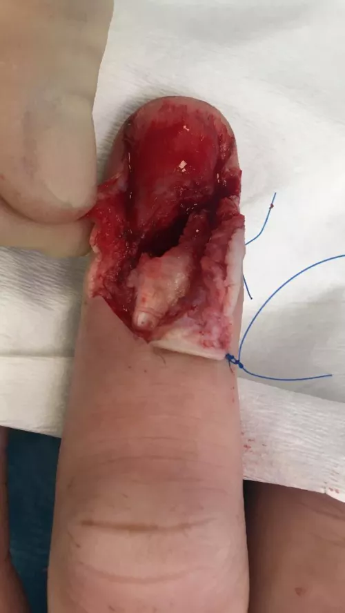 Anatomy of a fingertip