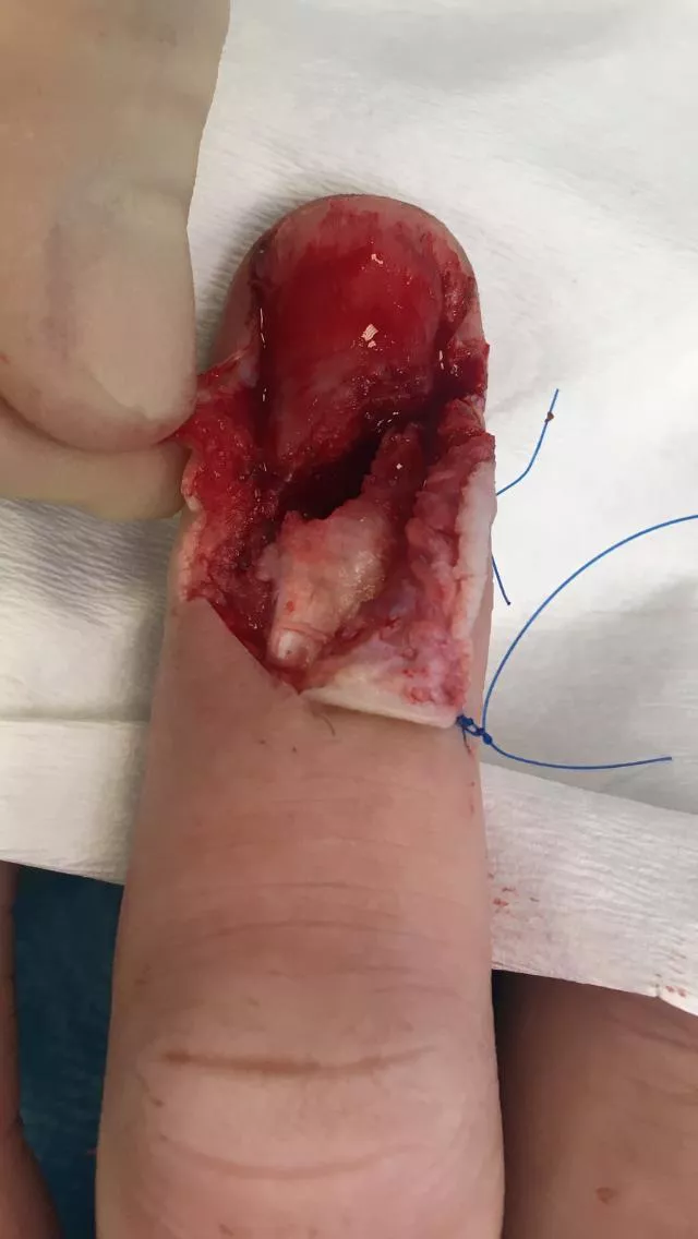 Anatomy of a fingertip