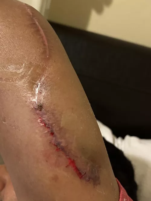 Does the arm look okay or should i be concerned?