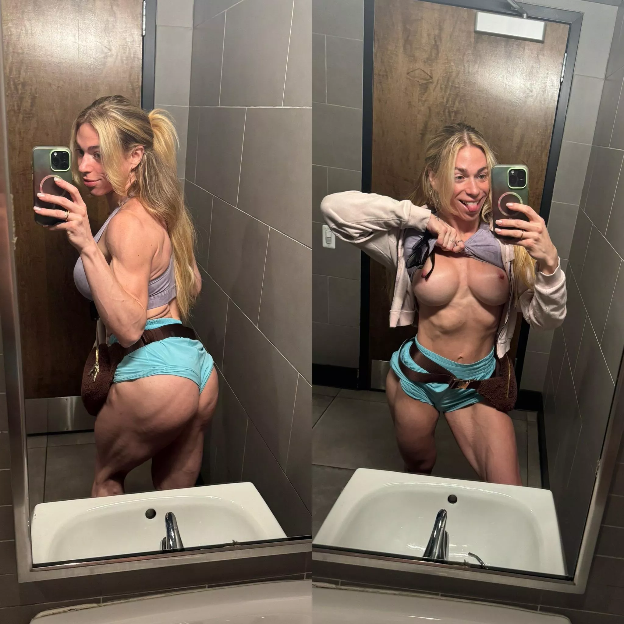 Glute striations or abs?