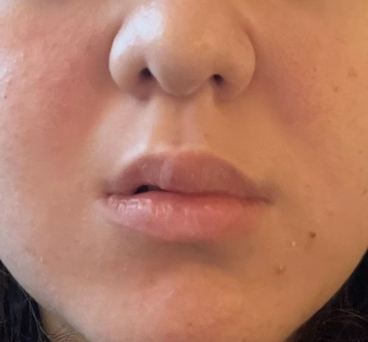 My lip won’t fully close and my left side of my face feels tensioned